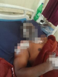 जोखिम भरा काम, सुरक्षा गायब… और ऊपर से जिम्मेदारी से किनारा